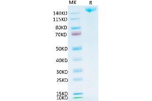 SARS-COV-2 Spike S Trimer on Tris-Bis PAGE under reduced condition. (SARS-CoV-2 Spike Protein (Trimer) (His-Avi Tag))