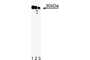 Western Blotting (WB) image for anti-Ribosomal Protein S6 Kinase, 90kDa, Polypeptide 1 (RPS6KA1) (AA 1-184) antibody (ABIN967838) (RPS6KA1 antibody  (AA 1-184))