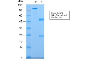SDS-PAGE Analysis of Purified CELA3B Rabbit Recombinant Monoclonal Antibody (CELA3B/2809R). (Recombinant Elastase 3B antibody  (AA 82-238))