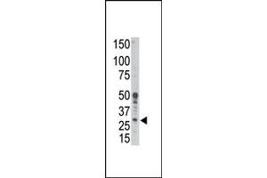 Image no. 1 for anti-BCL2-Related Protein A1 (BCL2A1) (BH3 Domain), (N-Term) antibody (ABIN356809) (BCL2A1 antibody  (BH3 Domain, N-Term))