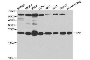 Western blot analysis of extracts of various cell lines, using TPT1 antibody. (TPT1 antibody  (AA 1-172))
