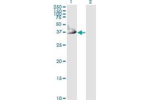 Western Blot analysis of CRYM expression in transfected 293T cell line by CRYM monoclonal antibody (M03), clone 6B3. (CRYM antibody  (AA 215-314))