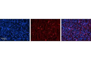 Immunohistochemistry (IHC) image for anti-Cytochrome P450, Family 3, Subfamily A, Polypeptide 4 (CYP3A4) (Middle Region) antibody (ABIN2783885)