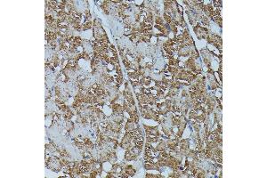 Immunohistochemistry of paraffin-embedded rat heart using FKBP1B antibody (ABIN7267212) at dilution of 1:100 (40x lens). (FKBP1B antibody  (AA 1-80))