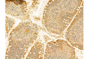 ABIN6255185 and ABIN6267483 at 1/100 staining Rat colon tissue by IHC-P. (IRS1 antibody  (pSer307))