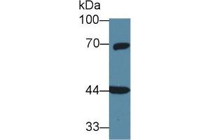 Western Blot; Sample: Rat Cerebrum lysate; Primary Ab: 1µg/ml Rabbit Anti-Human GNa11 Antibody Second Ab: 0. (GNA11 antibody  (AA 1-359))