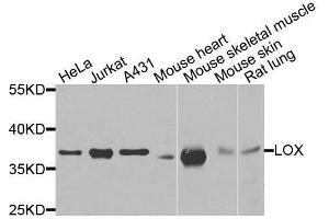 Western blot analysis of extracts of various cell lines, using LOX antibody.