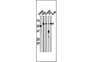 The anti-BECN1 Pab (ABIN388546 and ABIN2849692) is used in Western blot to detect BECN1 in, from left to right, , Hela, mouse brain, Y79, and HL60 tissue lysates.