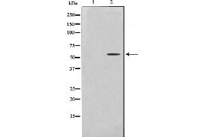 Western blot analysis on HeLa cell lysate using Cytochrome P450 2U1 Antibody，The lane on the left is treated with the antigen-specific peptide. (CYP2U1 antibody  (Internal Region))