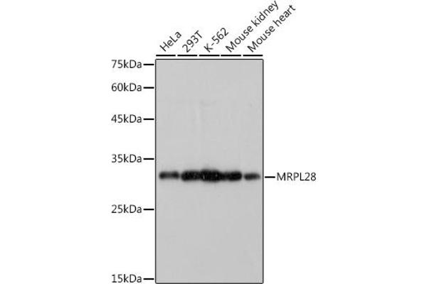 MRPL28 antibody