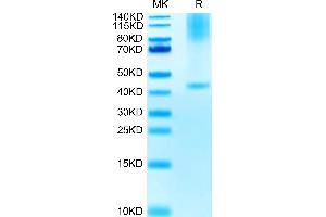 Glypican 3 Protein (GPC3) (AA 25-559) (His tag)