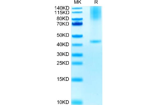 Glypican 3 Protein (GPC3) (AA 25-559) (His tag)