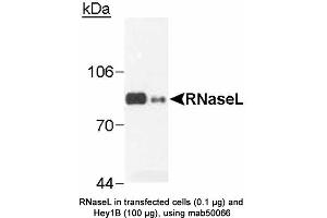 Image no. 2 for anti-Ribonuclease L (2',5'-Oligoisoadenylate Synthetase-Dependent) (RNASEL) antibody (ABIN363220) (RNASEL antibody)