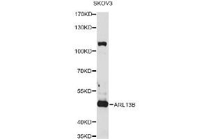 Western blot analysis of extracts of SKOV3 cells, using ARL13B antibody (ABIN1876411) at 1:1000 dilution. (ARL13B antibody)