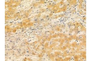 ABIN6257587 and ABIN6274867 at 1/100 staining human normal liver tissue by IHC-P. (ARSF antibody  (Internal Region))