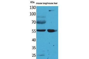 Western Blotting (WB) image for anti-Aldehyde Dehydrogenase 1 Family, Member A1 (ALDH1A1) (N-Term) antibody (ABIN3187700)