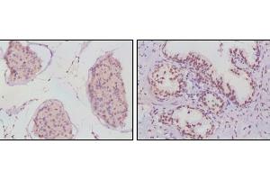 Immunohistochemistry (IHC) image for anti-Androgen Receptor (AR) antibody (ABIN1724724)