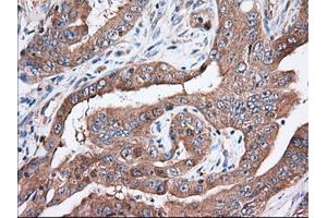 Immunohistochemical staining of paraffin-embedded Human Kidney tissue using anti-TTC32 mouse monoclonal antibody. (TTC32 antibody)