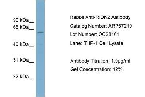WB Suggested Anti-RIOK2  Antibody Titration: 0. (RIOK2 antibody  (Middle Region))
