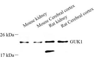 Western blot analysis of GUK1 (ABIN7074153) at dilution of 1: 500 (GUK1 antibody)
