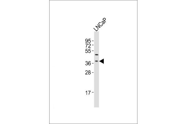 LGALS8 antibody  (C-Term)