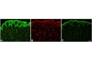 Immunofluorescence staining with consecutive sections of unfixed, human foreskin. (VEGFR2/CD309 antibody  (AA 20-678))