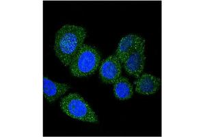 Image no. 3 for anti-Acyl-CoA Synthetase Long-Chain Family Member 4 (ACSL4) (AA 244-274) antibody (ABIN357780) (ACSL4 antibody  (AA 244-274))
