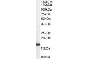 Western Blotting (WB) image for Von Hippel-Lindau Tumor Suppressor, E3 Ubiquitin Protein Ligase (VHL) peptide (ABIN369828)