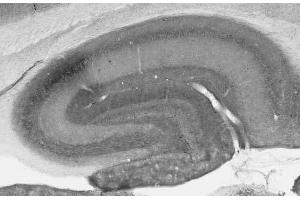 Adult rat hippocampus immunohistochemistry (with antigen retrieval via Na citrate pretreatment).