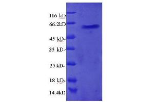 Ribosomal Protein L5 (RPL5) (AA 2-297), (full length) protein (GST tag)