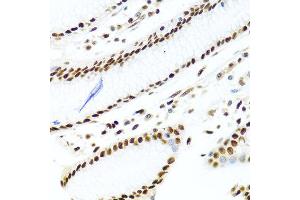 Immunohistochemistry of paraffin-embedded human stomach using SSB antibody at dilution of 1:100 (40x lens). (SSB antibody)