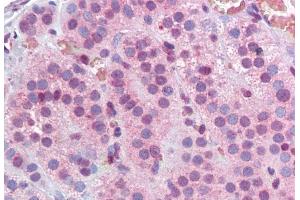 Immunohistochemistry (IHC) image for anti-Methyl-CpG Binding Domain Protein 2 (MBD2) (Internal Region) antibody (ABIN334432)
