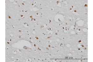 Immunoperoxidase of monoclonal antibody to TBL1XR1 on formalin-fixed paraffin-embedded human cerebral cortex. (TBL1XR1 antibody  (AA 81-178))