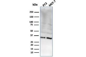 Western Blot Analysis of PC3 and MCF-7 cell lysate using NKX2. (NKX2-8 antibody  (AA 10-123))