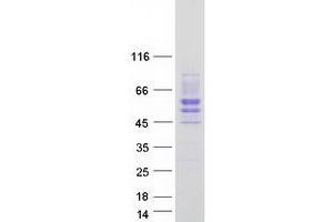 Western Blotting (WB) image for Single Immunoglobulin and Toll-Interleukin 1 Receptor (TIR) Domain (SIGIRR) (Transcript Variant 3) protein (Myc-DYKDDDDK Tag) (ABIN2732046)