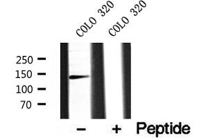 Western blot analysis of extracts of COLO 320 cells, using AP3B1 antibody. (AP3B1 antibody  (C-Term))