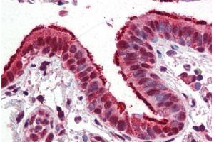 Human Lung, Respiratory Epithelium (formalin-fixed, paraffin-embedded) stained with FOXP1 antibody ABIN364260 at 10 ug/ml followed by biotinylated anti-mouse IgG secondary antibody ABIN481714, alkaline phosphatase-streptavidin and chromogen. (FOXP1 antibody)