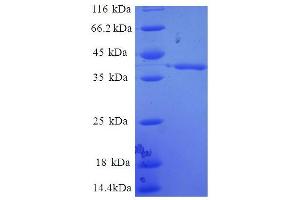 SDS-PAGE (SDS) image for Enhancer of Rudimentary Homolog (ERH) (AA 2-104) protein (GST tag) (ABIN4974469)