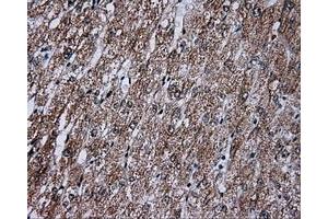 Immunohistochemical staining of paraffin-embedded liver tissue using anti-FAHD2A mouse monoclonal antibody. (FAHD2A antibody)