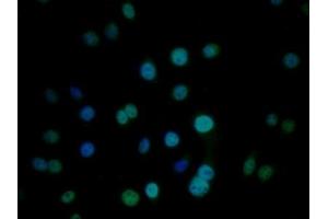 Detection of CIRBP in Human HepG2 cell using Polyclonal Antibody to Cold Inducible RNA Binding Protein (CIRBP) (CIRBP antibody  (AA 1-172))