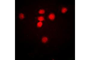 Immunofluorescent analysis of CBP (AcK1535) staining in HeLa cells. (CBP antibody  (acLys1535))