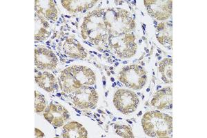 Immunohistochemistry of paraffin-embedded human stomach using CTSC antibody (ABIN5974676) at dilution of 1/100 (40x lens). (CTSC antibody)