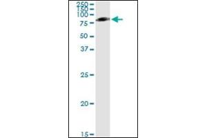 Western Blotting (WB) image for anti-Serpin Peptidase Inhibitor, Clade G (C1 Inhibitor), Member 1 (SERPING1) (AA 1-501) antibody (ABIN782340) (SERPING1 antibody  (AA 1-501))