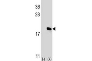 Western blot analysis of IL-17 antibody and 293 cell lysate (2 ug/lane) either nontransfected (Lane 1) or transiently transfected (2) with the IL17A gene. (Interleukin 17a antibody  (AA 61-87))