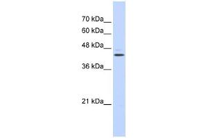 WB Suggested Anti-GABPB2 Antibody Titration: 0. (GABPB2 antibody  (N-Term))