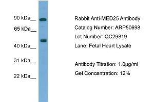 WB Suggested Anti-MED25  Antibody Titration: 0. (MED25 antibody  (N-Term))
