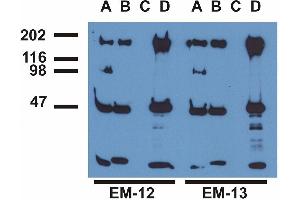 Immunoprecipitation ofEGFR from EGF-treated A431 cells by monoclonal antibodies (A), EM-13 (B), a commercial anti-EGFR polyclonal antibody (C)and anti-EGFR monoclonal mAb108 (D). (EGFR antibody  (pTyr992))