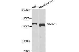 Western blot analysis of extracts of various cell lines, using CARD11 antibody (ABIN5974295) at 1/1000 dilution. (CARD11 antibody)
