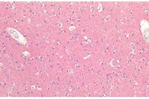 Immunohistochemistry analysis using Rabbit Anti-Tau Polyclonal Antibody (ABIN6698783). (tau antibody  (PE))