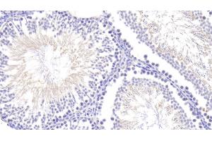 Detection of ANG in Rat Testis Tissue using Polyclonal Antibody to Angiogenin (ANG) (ANG antibody  (AA 25-142))